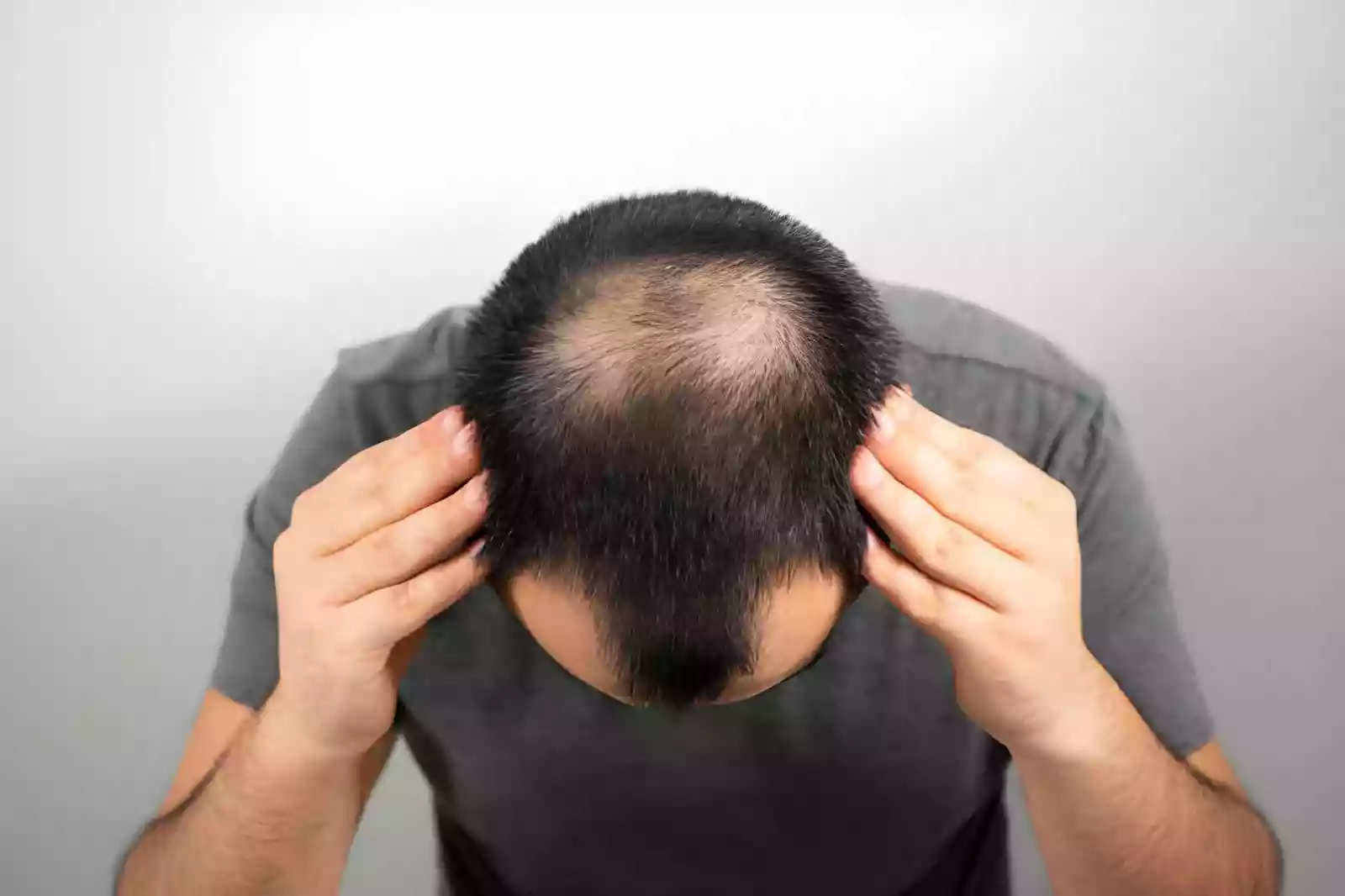 What Turkey hair transplant packages include